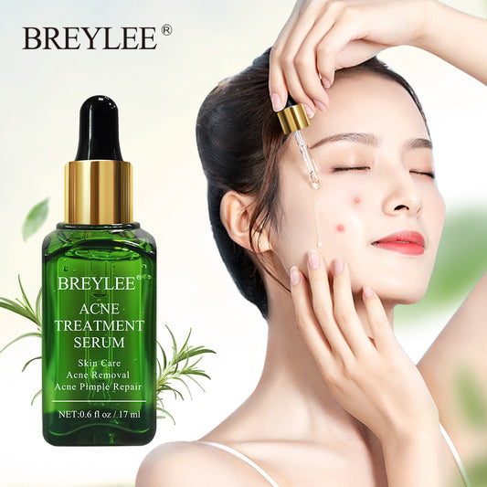 Acne Treatment Face Serum Mask Anti Acne Pimple Scar Remove  17ml